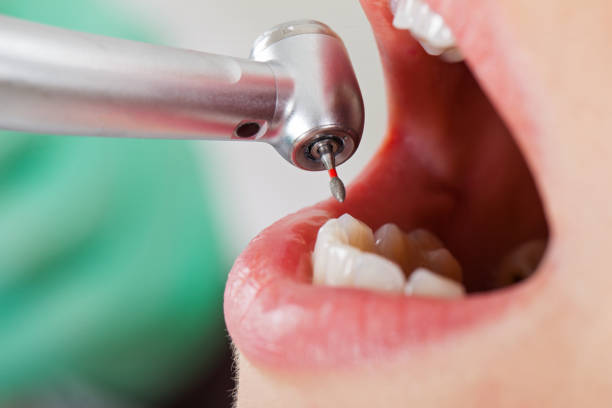Best Emergency Dental Services for Seniors in Siesta Acres, TX